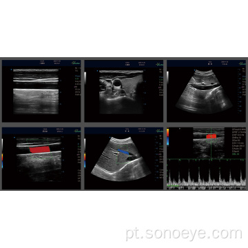 Máquina de ultra-som portátil com bom preço